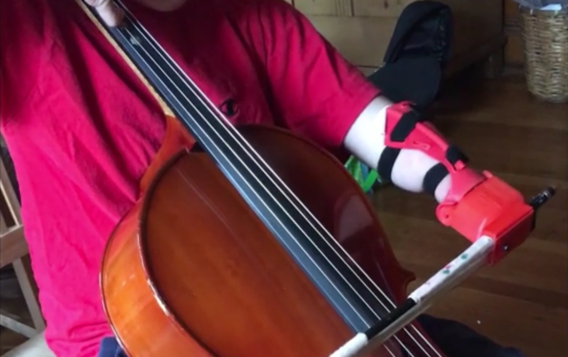 Cello prosthetic