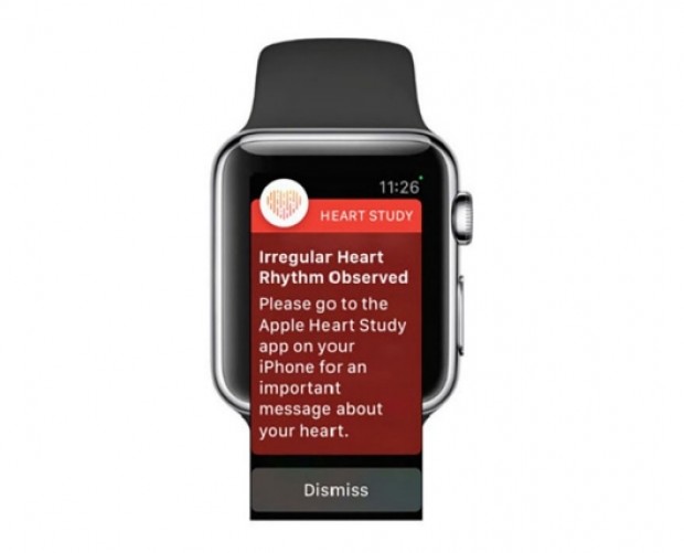Apple Watch Heart Study has over 400,000 participants